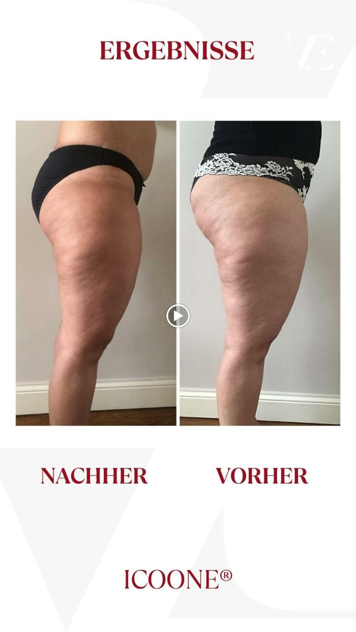 Vitalite Esthetics | Kosmetikstudio Wien | Morpheus 8 & Hydrafacial, Führichgasse in Wien