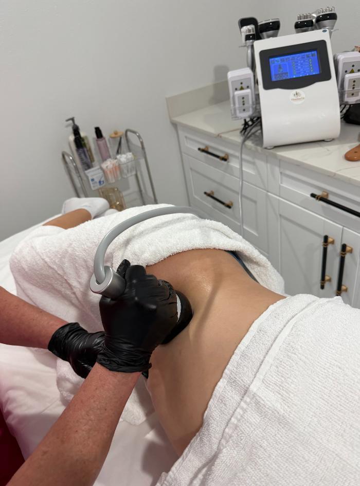 Cavitation Therapy 