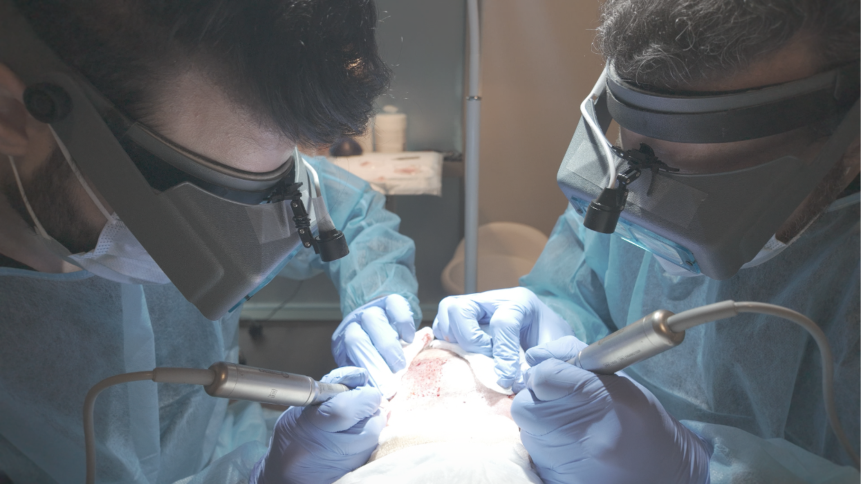 Dual FUE extractions