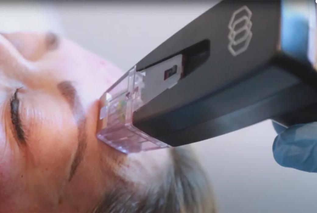EverYoung Laser & Skin Clinic Vancouver