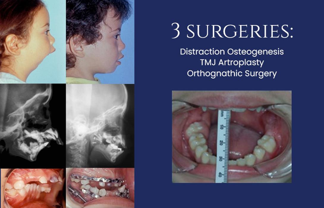 Cesar Guerrero, DDS