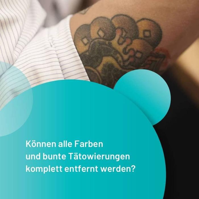 ENDLICH OHNE Tattooentfernung Filiale Unterschleißheim, Alleestraße in Unterschleißheim