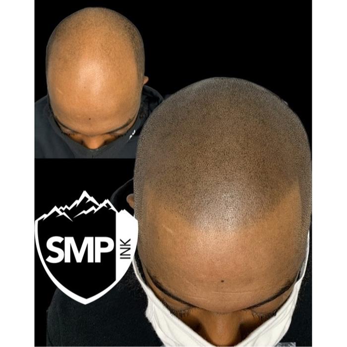 SMP INK Seattle #1 SMP studio in PNW schedule free consultation!