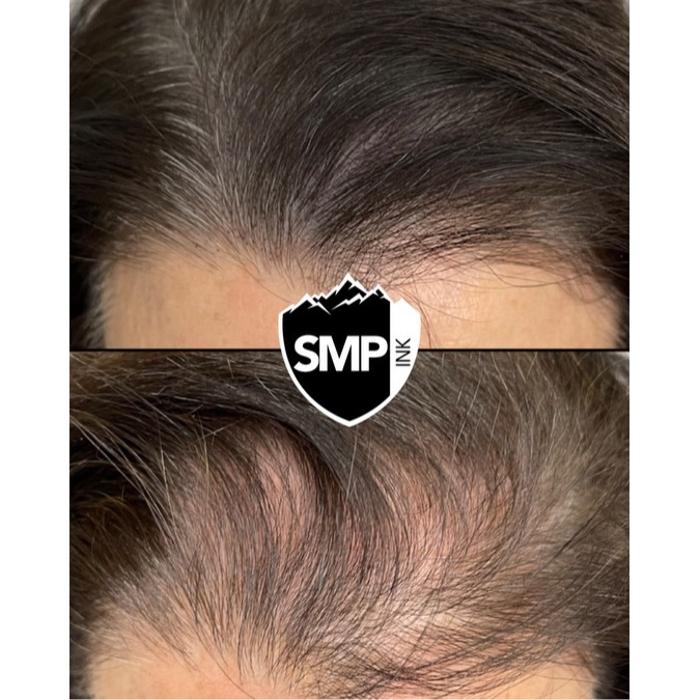 SMP INK Seattle #1 SMP studio in PNW schedule free consultation!
