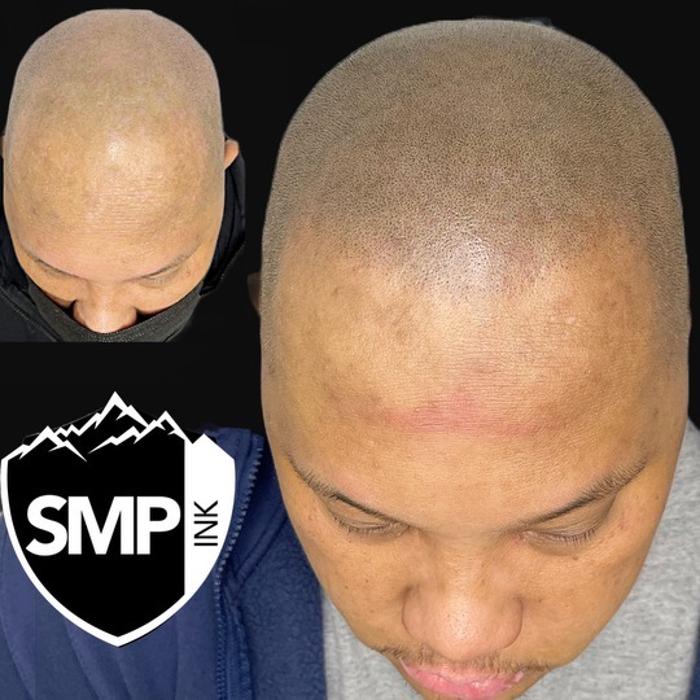 SMP INK Seattle #1 SMP studio in PNW schedule free consultation!