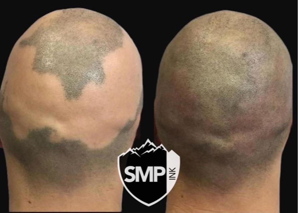 SMP INK Seattle #1 SMP studio in PNW schedule free consultation!