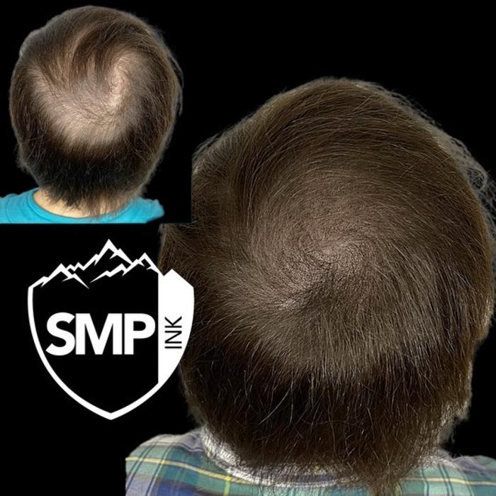 SMP INK Seattle #1 SMP studio in PNW schedule free consultation!