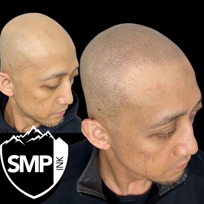 SMP INK Seattle #1 SMP studio in PNW schedule free consultation!