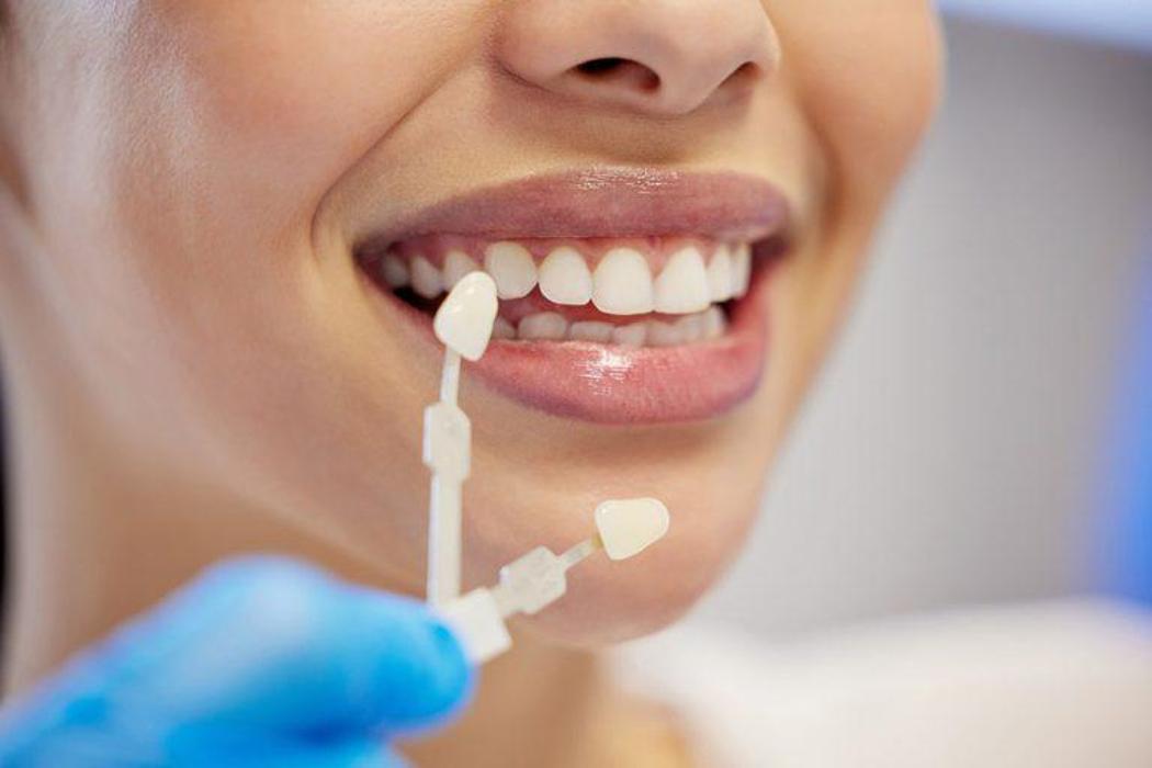 Dr. Stoll Smile Design, Löwenstrasse in Zürich