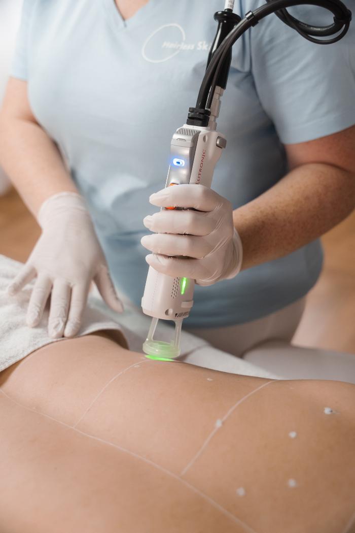 Hairless Skin Mainz - Fachinstitut für Laser Haarentfernung, Fischtorplatz in Mainz