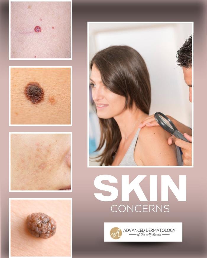 Advanced Dermatology Of The Midlands, PC Image