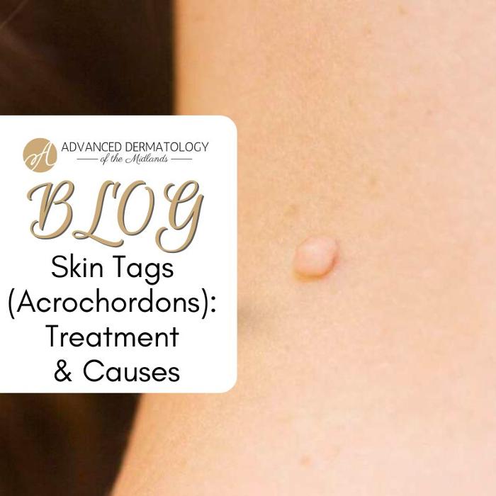 Advanced Dermatology Of The Midlands, PC Image