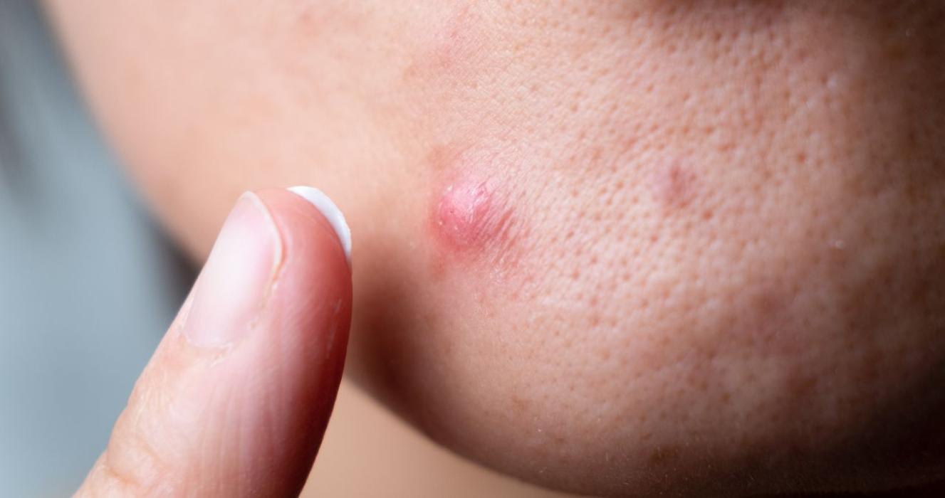 Advanced Dermatology of the Midlands Image