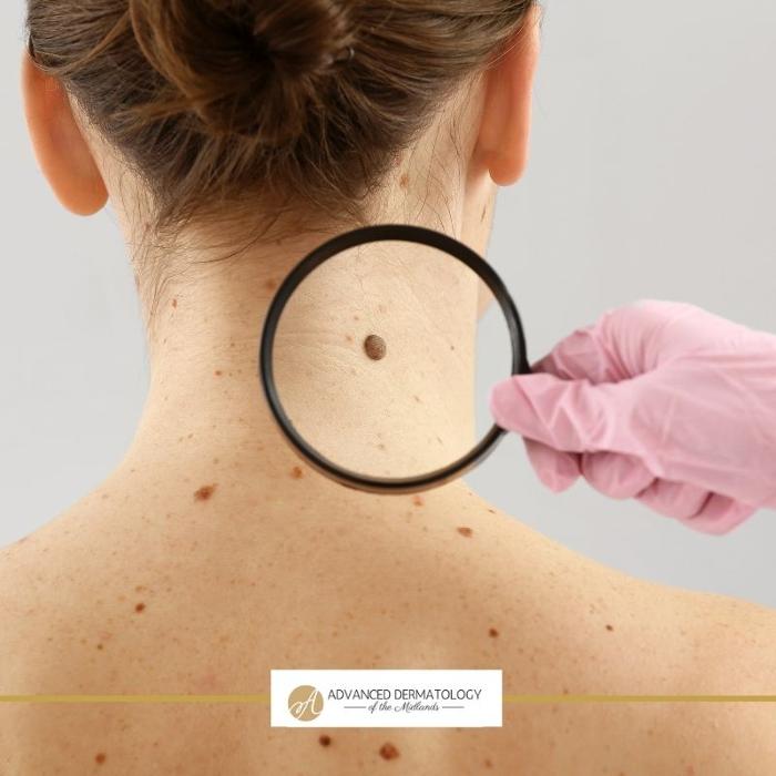 Advanced Dermatology of the Midlands Image