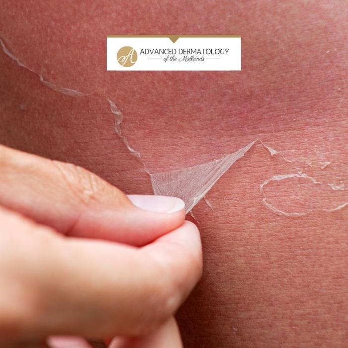 Advanced Dermatology of the Midlands Image