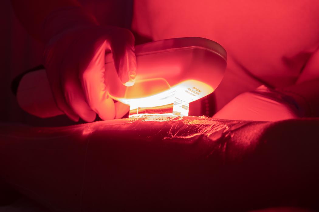 Haarentfernung Erding - Hairless Skin in Erding