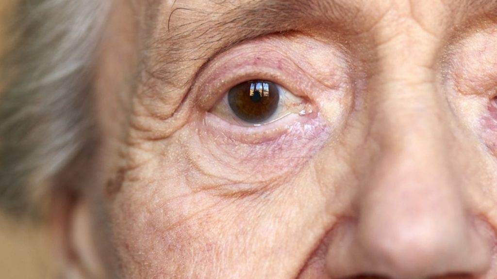 Sağlıklı kolesterol Alzheimer riskini azaltıyor