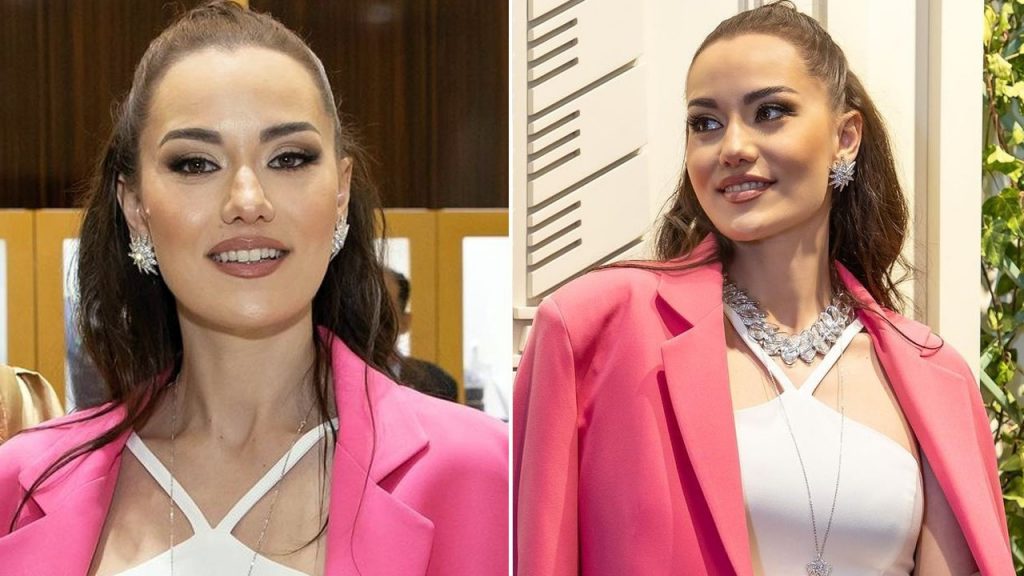 Fahriye Evcen saçlarını kaybediyor