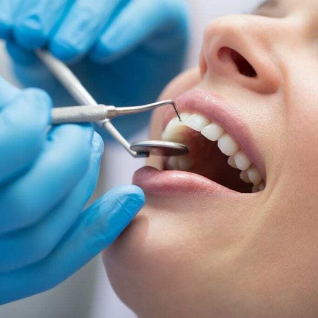 Zircon Crown discount at Unicare Dental Center W.L.L