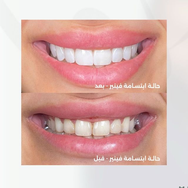 50% Off! discount at Alba Dental Clinic