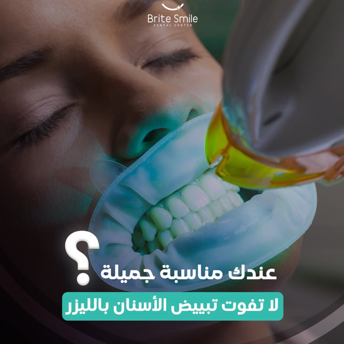 3 Whitening Sessions + Cleaning for 55 BD! offer at Brite Smile Dental Center