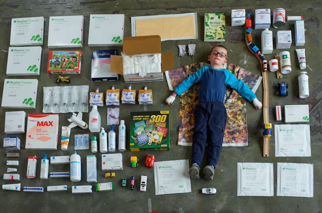 Konkrétní materiální pomoc lidem s nemocí motýlích křídel