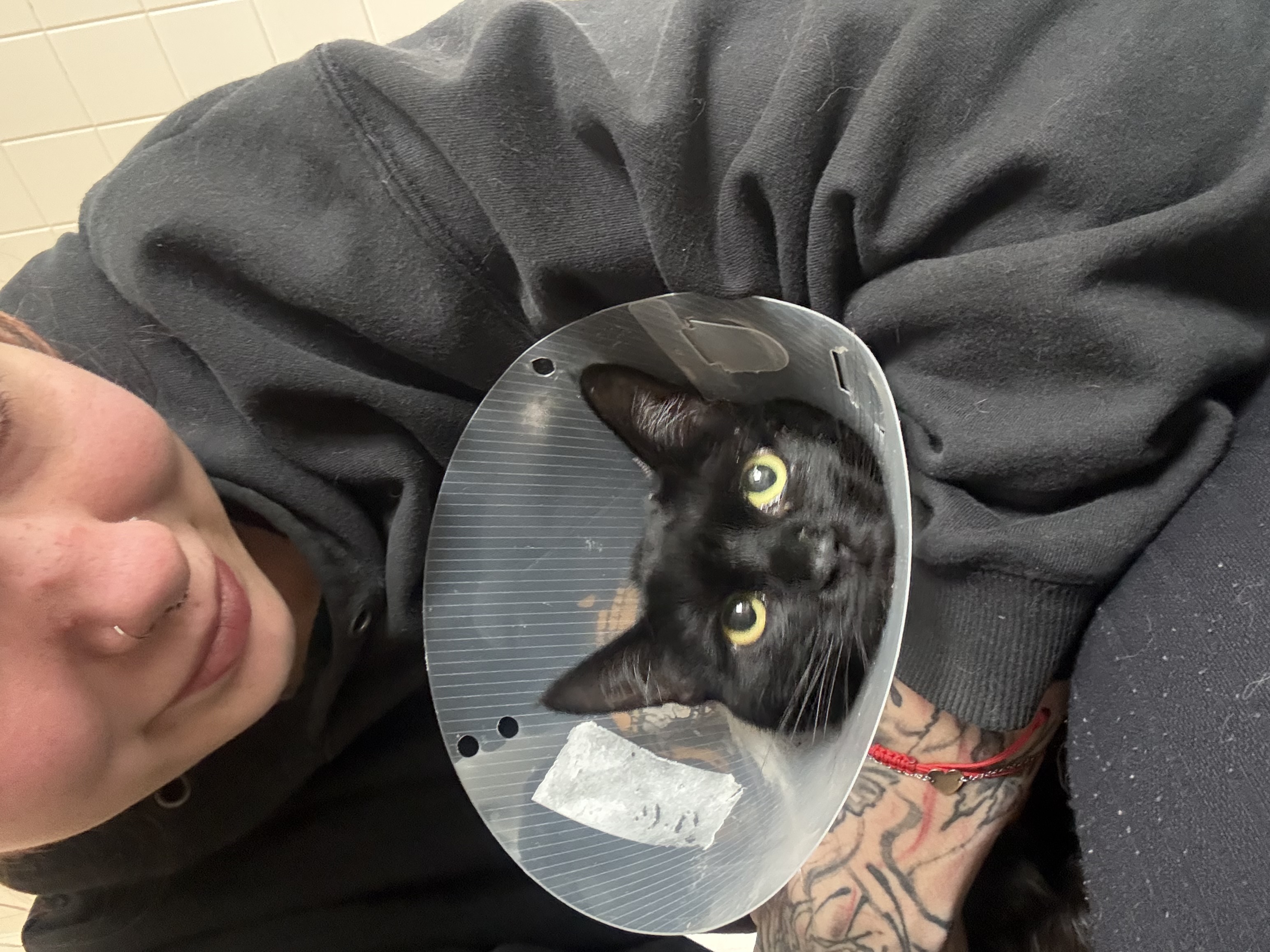 Pomoc Angelince s akutním zánětem slinivky