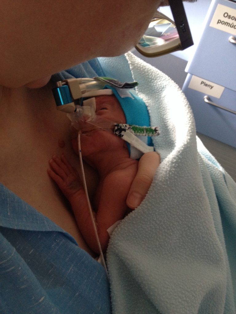 Podpořme nedonošená miminka