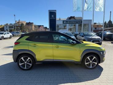 SPOTICAR Hyundai Kona 1.6 T-gdi Style 4wd Dct Uzywany - Suv Benzyna Zielony - Kraków - 1200221508_4