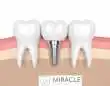 miracle dental