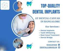 Top-Quality Dental Implants in Bangalore, Bengaluru