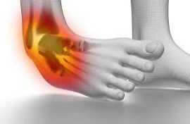 5 Effective treatment for ankle ligament surgery, Novena
