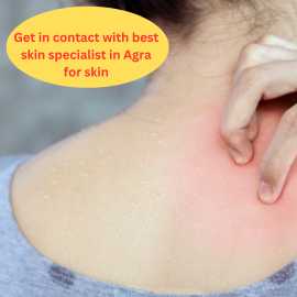 Skin Specialist In Agra For Healthy Glowing Skin, Agra