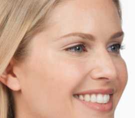 Botox San Francisco - Botox Injections Cost Bay Ar, San Francisco
