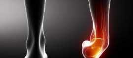 6 Common options for sprained ankle treatment, Novena