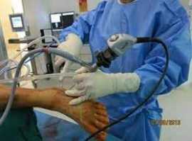 5 Things to consider after ankle fracture surgery, Novena