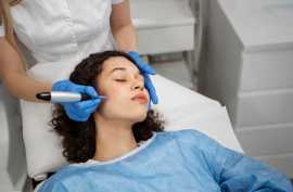 The Incredible Impact of laser skin tightening las, Las Vegas