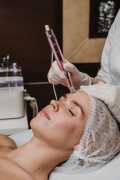J Plasma Renuvion Skin Tightening in San Francisco, San Francisco