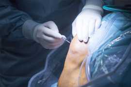Best Doctors for Arthroscopy Surgery In Jaipur, Jaipur