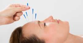 Find Highly Experienced Acupuncture Treatment , London