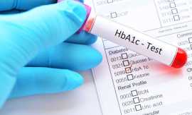 Accurate & Affordable Sugar Test HbA1c Test , Indore