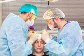 How to find the Best Hair Transplant Surgeon , Kolkata