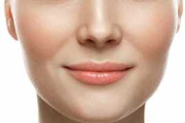 Cheek Implant San Francisco: Procedure, Recovery, , San Francisco