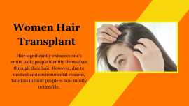 Women Hair Transplant In Delhi - DMC Trichology, New Delhi