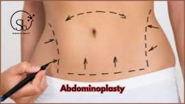 Abdominoplasty in Hyderabad, Hyderabad