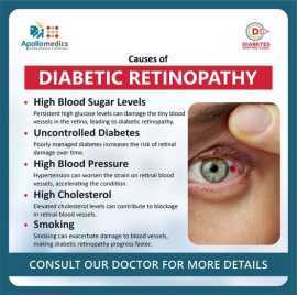 Stop Diabetic Retinopathy in Its Tracks!  , Lucknow