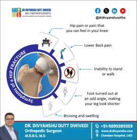 Know the Signs of a Hip Fracture, Lucknow
