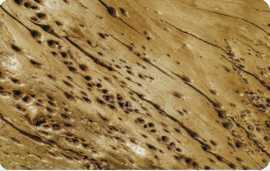 Effective Termite Pest Control , Lakemba
