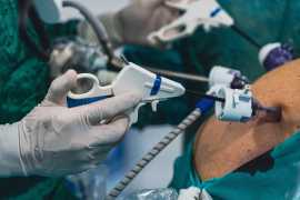 Gastric Sleeve in Mexico – Expert Care, Low Cost, San Diego