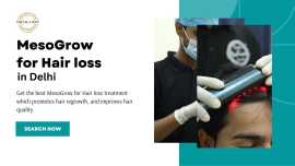 Mesogrow For Hair Loss In Delhi | DMC Trichology, New Delhi